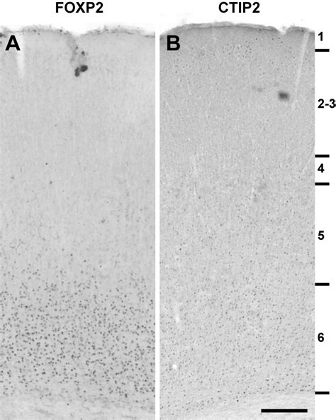 Position Of Neocortical Neurons Transfected At Different Gestational