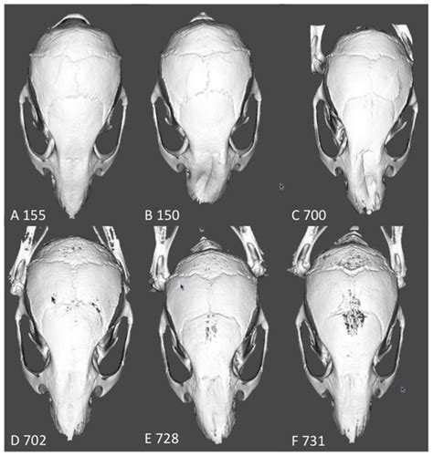 The Craniofacial Phenotype Is Highly Variable Ranging From An Almost