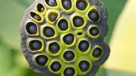 Trypophobia Skin Causes