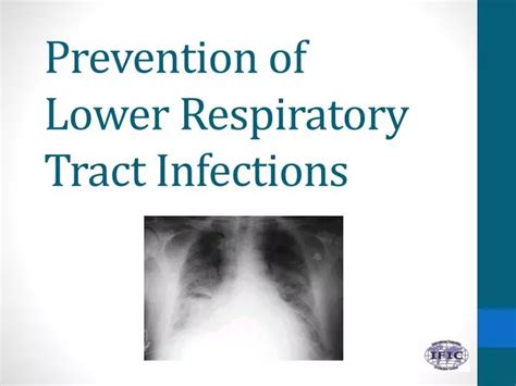 Ppt Prevention Of Lower Respiratory Tract Infections Powerpoint