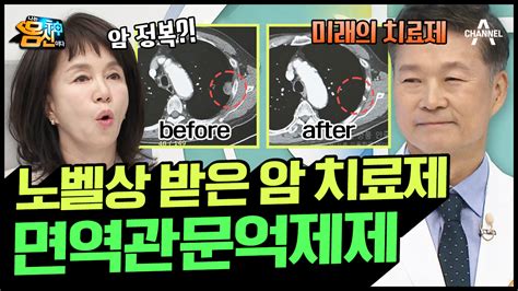 나는몸신이다 폐암 4기 환우도 억제제 3번 만에 완치완전 관해 가능 암 면역항암제 보다