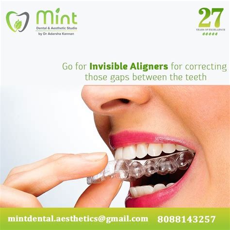 Invisible braces – Artofit