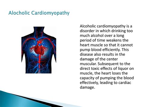 PPT - Alcoholic Cardiomyopathy PowerPoint Presentation, free download ...