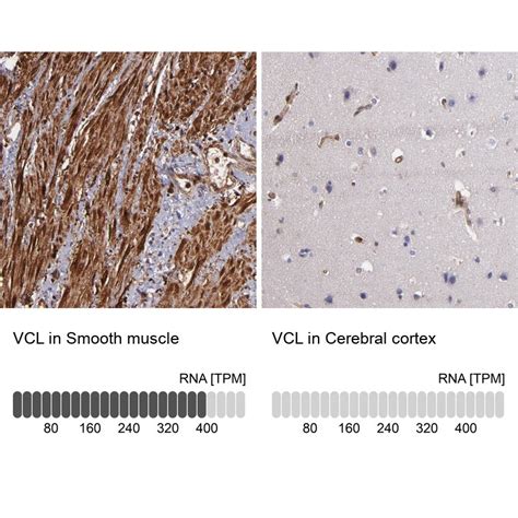 Vinculin Antibody (PA5-82003)