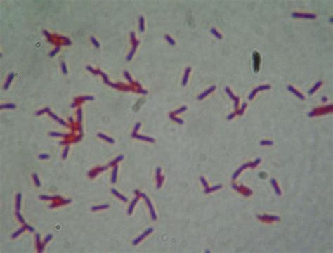 Endospore Stain Clostridium