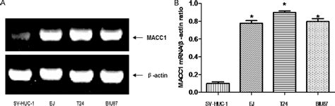 Figure 1 From Targeting Macc1 By Rna Interference Inhibits