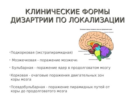 Дизартрия. Классификация - презентация онлайн