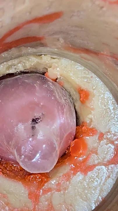 The Camera K Inside The Deep Pussy Records A Huge Ejaculation With A Stuck Condom Gay Porn