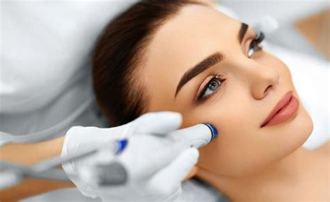 Pros and Cons of Microdermabrasion for Acne Scars