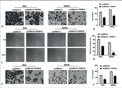 Figure 3 from TGFβ1I1 suppressed cell migration and invasion in ... 