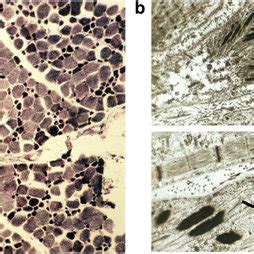 Light Microscopic Image Of The Nadhtr Stained Muscle Of The Proband Of