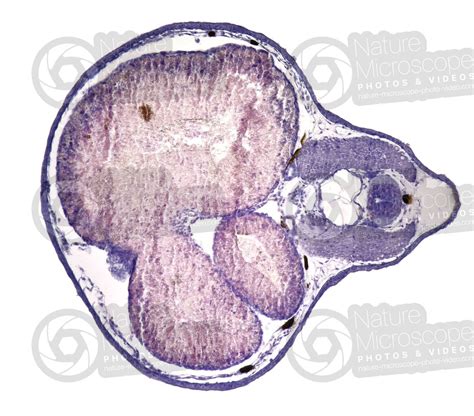 Xenopus Laevis Xenopo Liscio Girino Stadio Di Larva Sezione