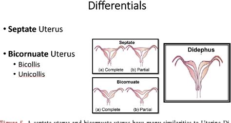 Figure 5 From Uterine Didelphys In A Pregnant Mother Semantic Scholar