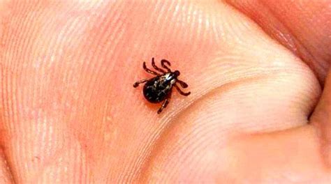 Lyme Hastal Nedir Belirtileri Nelerdir Tan Ve Tedavisi Nas L Yap L R