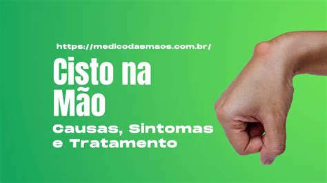 Cisto na Mão Causas Sintomas e Tratamento