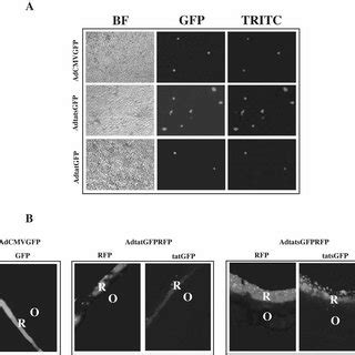 (A) Detection of GFP by fluorescence microscopy using an anti-GFP ...