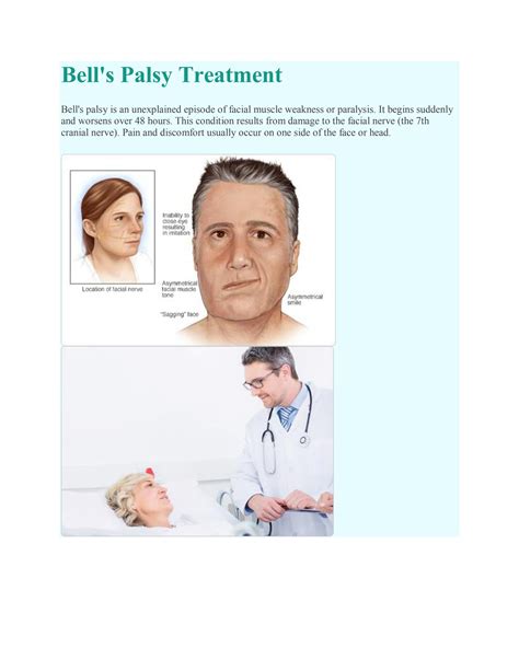 Bell's Palsy Treatment in India by Cardiology Treatment in India - Issuu