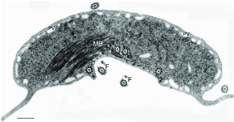 5 Routine Preparation For Transmission Electron Microscopy Of G Download Scientific Diagram