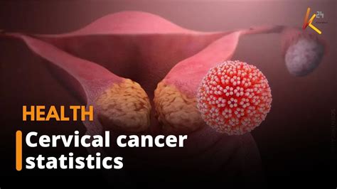 Statistics Show That 9 Women Lose Their Lives To Cervical Cancer Every