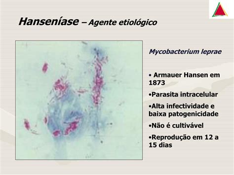 Agente Etiológico Da Hanseníase - PPT - HANSENÍASE Sensibilização PowerPoint Presentation, free download ...
