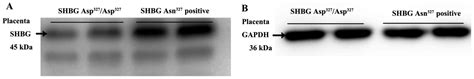 Effect Of Placental Sex Hormone Binding Globulin Single Nucleotide
