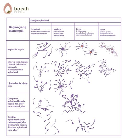 Sperm Agglutination On Male Fertility