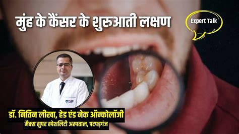 Oral Cancer Symptoms And Early Warning Signs Know From The Expert Where