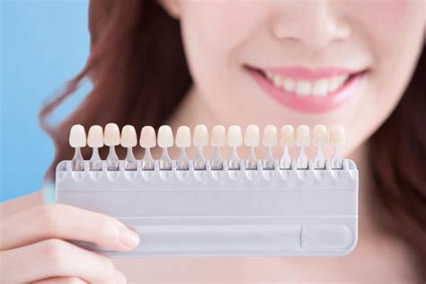 Important Facts To Know While Choosing Veneers