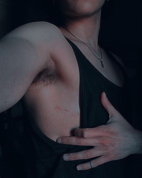 Surge of love for my scars (nsfw for shirtless pic on second slide) : r