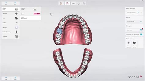 Introduction To 3shape Trios On Dental Desktop Youtube