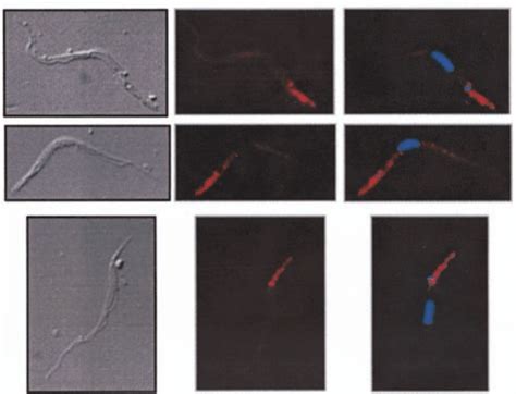 Morphometry Of Procyclic Cyc Rnai Cells A The Dimensions Of Induced