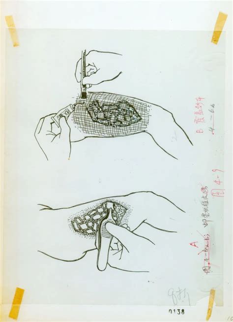 收藏：中国手外科手术切口及入路绘图原稿！ 德医学院 助力医学教育发展！