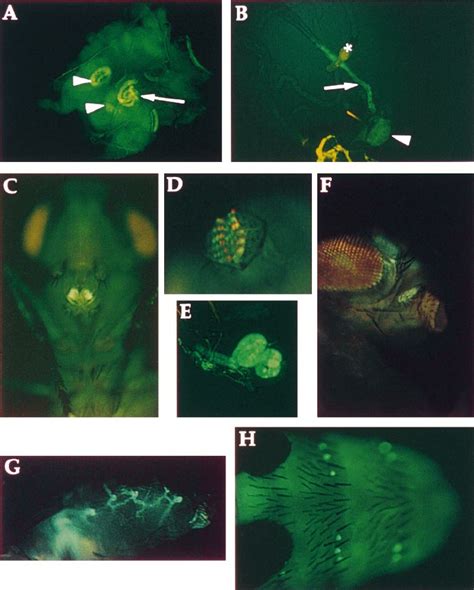 Localized Expression Of The Drosomycingfp Reporter Gene In Adults A