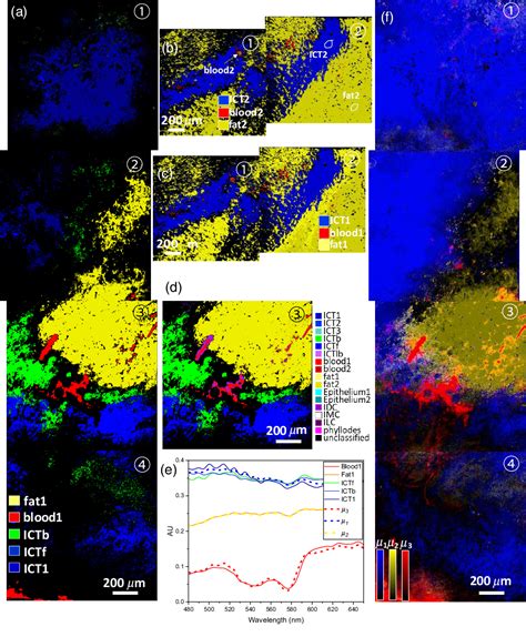 Figure 7 From Hyperspectral Dark Field Microscopy Of Human Breast