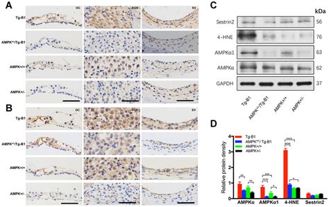 Down Regulation Of Ampk Signaling Pathway Rescues Hearing Loss In Tfb