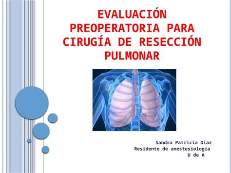 PPTX E VALUACIÓN PREOPERATORIA PARA CIRUGÍA DE RESECCIÓN PULMONAR