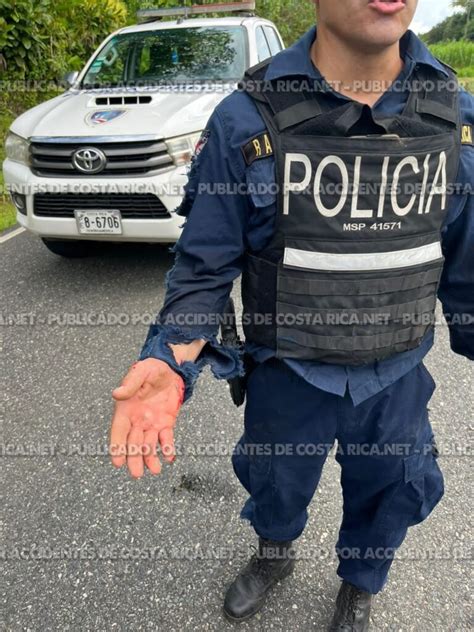 Accidente En Piedras Blancas Osa Colisi N Entre Moto Del Msp Y