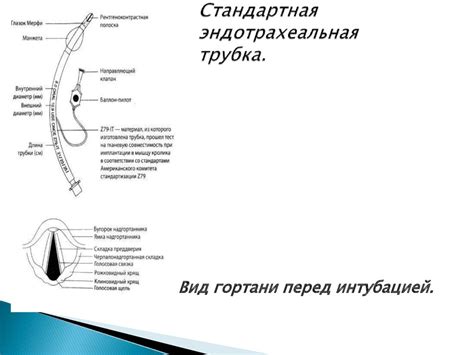 Интубация трахеи. Виды, техника, осложнения. Алгоритм трудной интубации ...