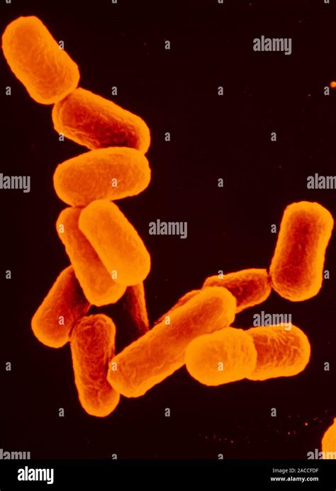 Escherichia Coli Coloured Scanning Electron Micrograph Of Escherichia Coli Bacteria A Gram