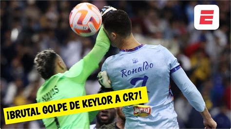 En La Cara No Keylor EL GOLPE BRUTAL ENTRE CRISTIANO Y NAVAS Que