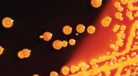 A killer among us: deadly CRE bacteria | Dentistry IQ