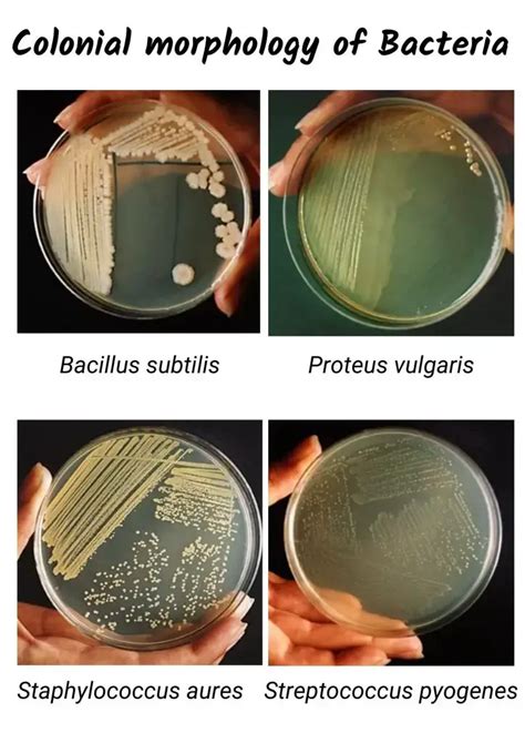 Colony Morphology of Bacteria and Examples - Biology Notes Online