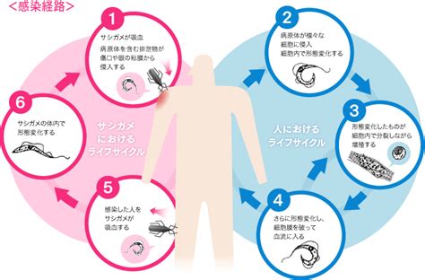 シャーガス病 顧みられない熱帯病と三大感染症について エーザイ株式会社