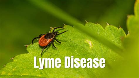 Lyme Disease Symptoms Causes Questions Answered St Michaels Elite Hospital