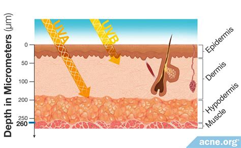 What's the Difference Between UVA and UVB Rays? - Acne.org