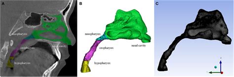 A A CBCT Slice Of The Upper Airway B 3D Model Of The Upper