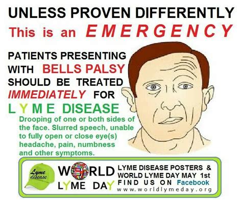 Bells Palsy Lyme Disease Awareness Bells Palsy Lyme Disease