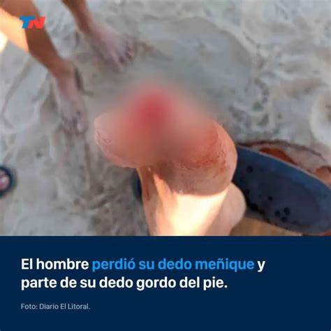 Alerta En El R O Paran Palometas Atacaron A Un Hombre Y Le Arrancaron