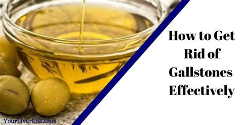 How to Get Rid of Gallstones Effectively - YourLiverLife