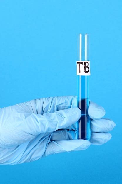 Пробирка с надписью TuberculosisTB в руке на синем фоне | Премиум Фото
